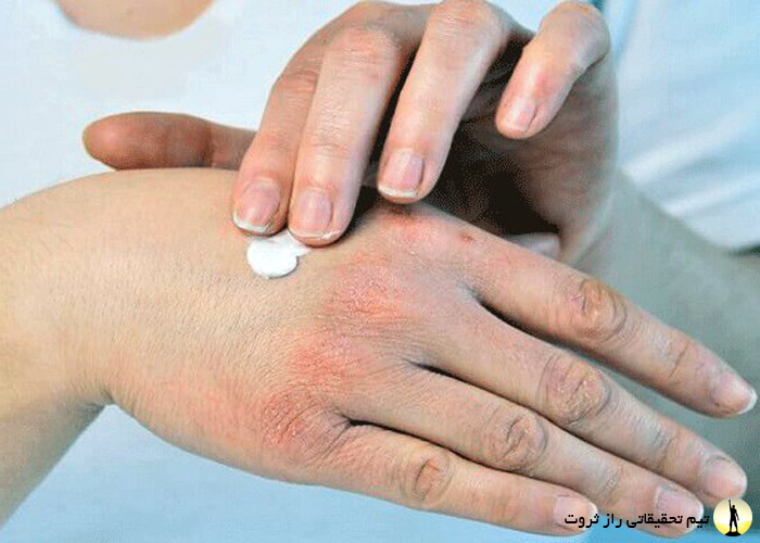 تاثیر استرس بر سلامت بدن