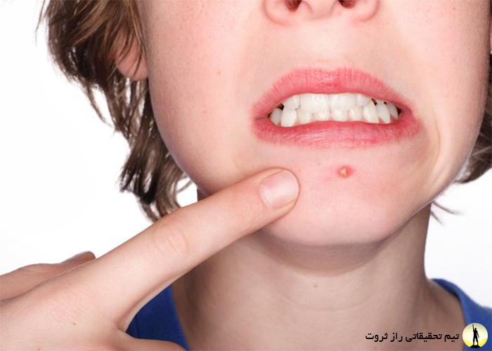 تاثیر استرس بر سلامت بدن