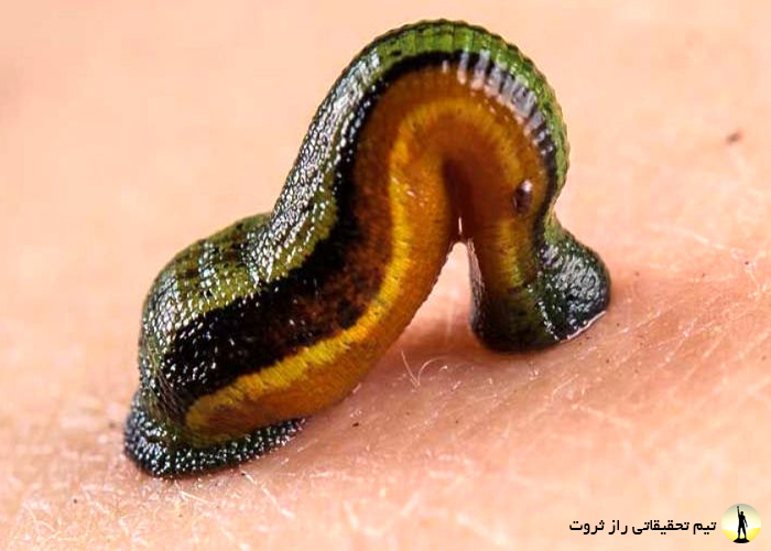 زالو درمانی چیست