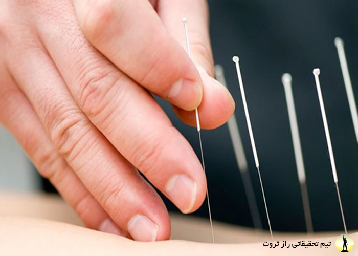 فواید طب سوزنی