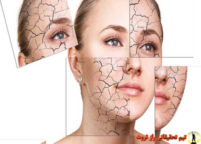 دلایل خشکی پوست چیست